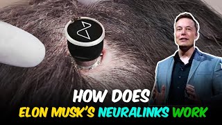 Unlocking Neuralink | How Elon Musk's Revolutionary Brain-Machine Interface Works!