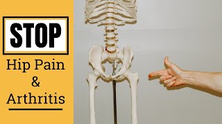Hip Pain and Hip Arthritis: Stop Pain with Simple Exercises