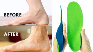 The Truth About Arch Support