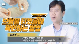 [가슴 수술] 모든 보형물은 파손,파열이 있다? 그런데 말입니다,,,🤔 보형물 터졌을 때 확인하는 방법!🙌 그것이 알고 싶다✨