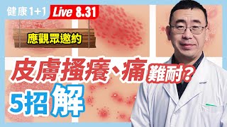 臉上長滿痘痘，快速祛痘不留疤有好方法嗎？患帶狀皰疹痛的死去活來！有哪些止痛妙招？香港腳又臭又癢、牛皮癬還侵害膝關節？惱人的皮膚病有解決方法，你可以這樣做！（2021.8.31）| 健康1加1 · 直播