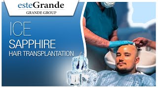 esteGrande Hair Transplant Journey - Ice Sapphire Micro FUE Part 3