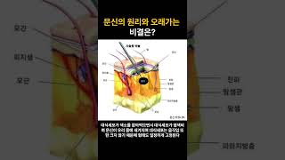 문신의 원리와 오래가는 비결은?