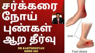 Foot Ulcer in Diabetes how to control in tamil | Doctor Karthikeyan