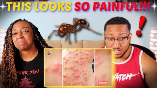 Brave Wilderness "Stung by 500 Fire Ants!" REACTION!!!