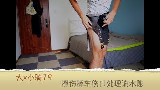 【大x小骑79】擦伤摔车伤口处理流水账