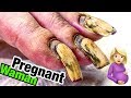 😱 Transformation Of Hardworker Pregnant Woman’s Nails 💅 The Week Before Going To Labor 🐣