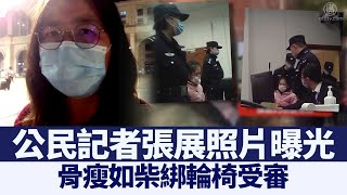 公民記者張展照片曝光 骨瘦如柴綁輪椅受審｜@ChinaBreakingNewsTV ｜20210207