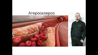 Атеросклероз - лекция доктор Голода