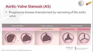 Pathophysiology of Aortic-Valve Stenosis