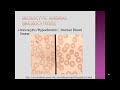 basic anemia lecture