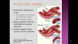 Basic Anemia Lecture