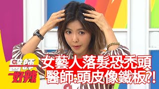 女藝人嚴重落髮恐禿頭？醫師：頭皮跟鐵板一樣！【@醫師好辣】20201026 part4 EP1038 許瓊月 潘映竹