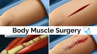 ASMR Body Muscle treatments | Broken Bone | body muscle surgery | broken bone surgery | Right-ASMR
