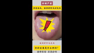 像这种舌象肝郁严重，但逍遥丸，柴胡舒肝丸却无效？