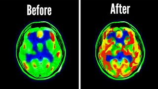How Dopamine Detoxing Changed My Brain