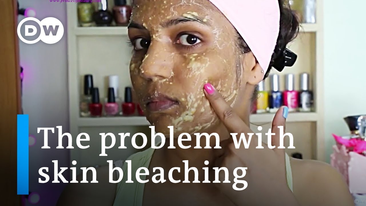 Why You Should Stop Bleaching Your Skin Right Now | DW Stories - YouTube