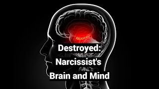 Destroyed: Narcissist's Brain and Mind (Infant Amnesia, Psychotic Grandiosity)