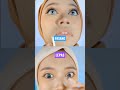 lepas dan pasang softlens