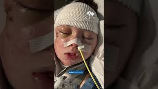 Miracle recovery: Whitfield County girl returns home after overcoming severe accident