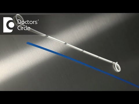 What is a Ureteral Stent? How is a stent placed & removed?-Dr. Manohar T What is a Ureteral Stent? How is a stent placed & removed?-Dr. Manohar T