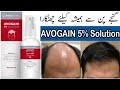 AVOGAIN 5% Solution Uses in Urdu | How to Use AVOGAIN Solution | Side Effects 