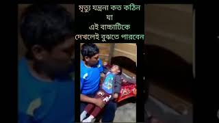 মৃত্যুর যন্ত্রনা কত কষ্টের যা বাচ্চাটিকে দেখলেই বুঝতে পারবেন