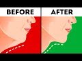 Download 6 Effective Ways to Get Rid of a Double Chin In Mp4 3Gp Full HD Video