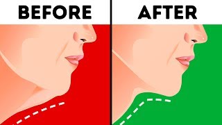 6 Effective Ways to Get Rid of a Double Chin