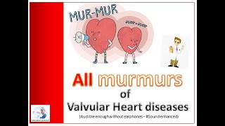 Murmurs of Valvular Heart Diseases (Sound enhanced)