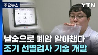 날숨으로 폐암 알아챈다...조기 선별검사 기술 개발 / YTN