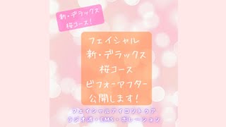 たった1回でこんなに上がりました【小顔・リフトアップ】