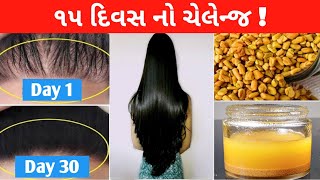 Best remedy for hair, વાળ વધારવા ની રીત, ખરતા વાળ અટકાવવાના ઉપાયો, વાળ ખરતા અટકાવવાની રીત #hair