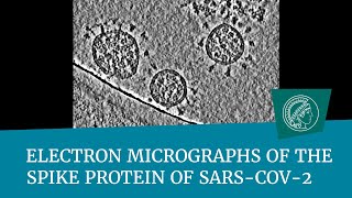 Electron micrographs of the spike protein of Sars-CoV-2