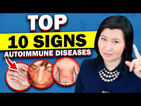 What autoimmune disease causes rashes?