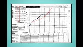 PARTOGRAMA-OBSTETRICIA-UTPL