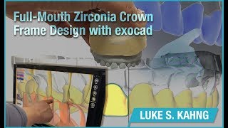 Full-Mouth Zirconia Crown Frame Design with exocad