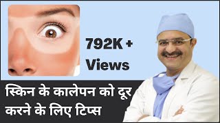 Skin Tanning \u0026 Tips for Tan Removal (स्किन के कालेपन को दूर करने के लिए टिप्स) | (In HINDI)