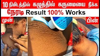 LIVE RESULT : 10 நிமிடங்களில் உங்கள் கழுத்து வெள்ளையாக | Dark Neck Home Remedy  \u0026 Whitening in tamil