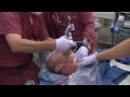 KingVision Channel and Standard blades in a bloody airway from AOD