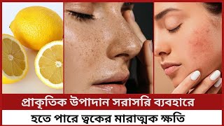 Skin damage from natural ingredients | প্রাকৃতিক উপাদান থেকে ত্বকের ক্ষতি | SADIKA TASMIM