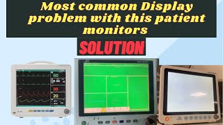 Most Common Display Problem with Patient Monitor Devices