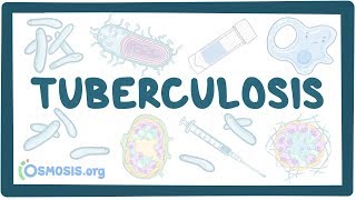 Tuberculosis - causes, symptoms, diagnosis, treatment, pathology