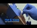 Anaesthesia: Rapid Recovery Hip Replacement