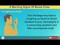 8 warning signs of blood clots that could save your life