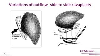 50. Liver Transplantation; (What Surgeons Expect from Radiologists). Part 1. By Prof. Abhinav Humar