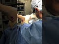 Endoscopic Gastroc release