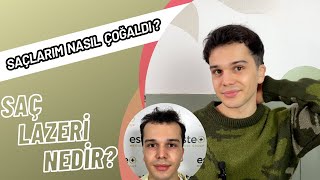 SAÇIM NASIL UZADI? - SAÇ UZATMA YÖNTEMLERİ