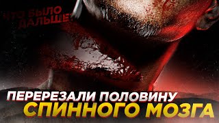 Перерезали половину спинного мозга | Что было дальше