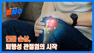 퇴행성 관절염의 시작, 연골 손상부터다? MBN 241225 방송